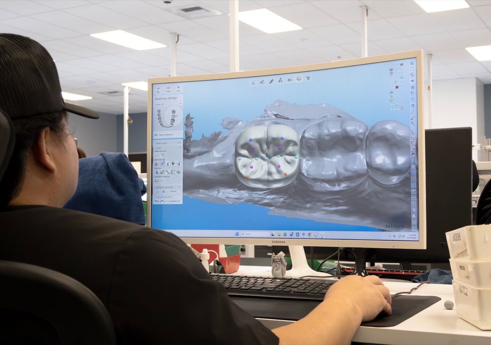 Digital Workflow / CAD CAM
