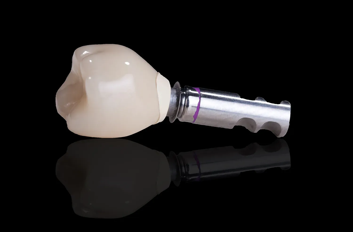 Implant Supported