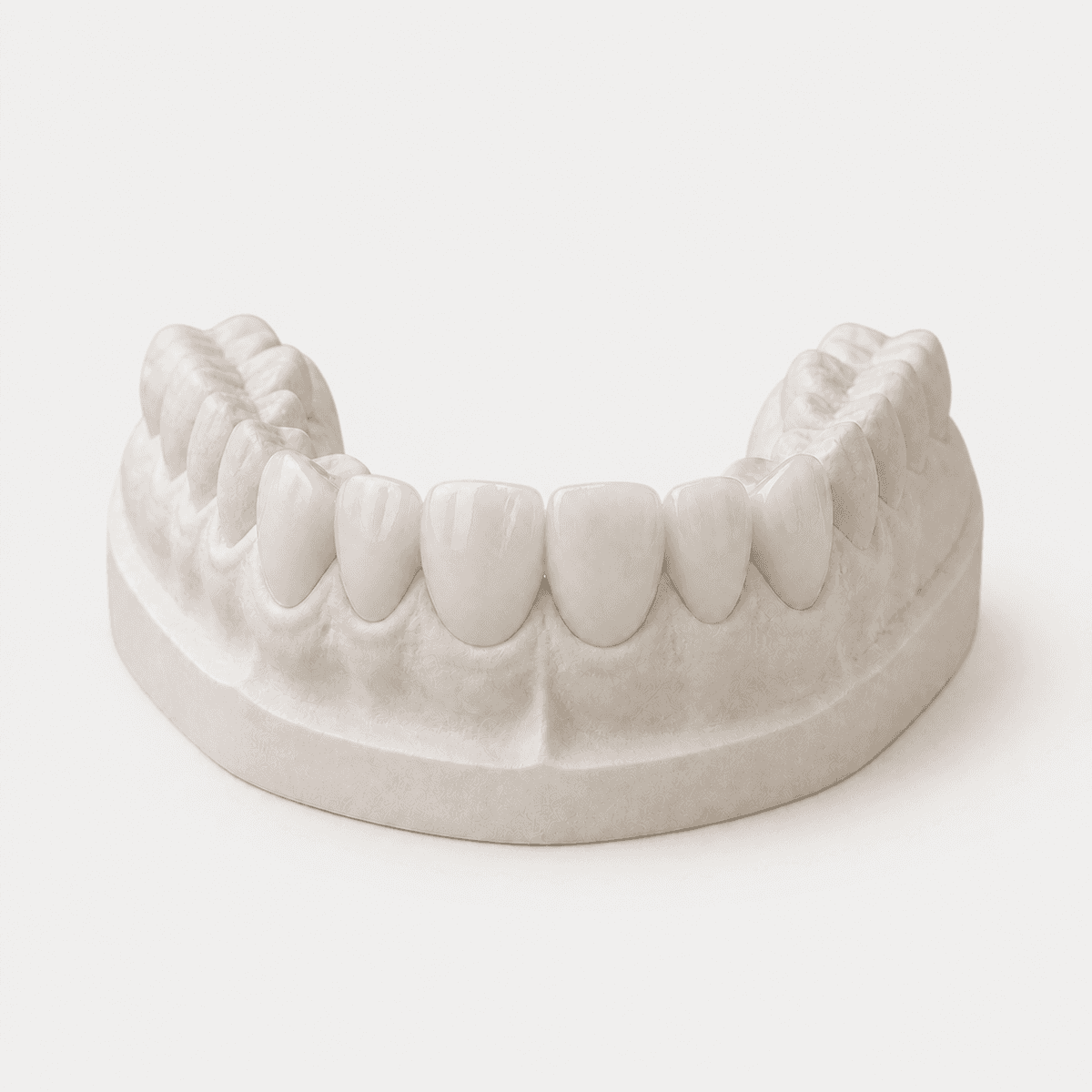 Diagnostic Wax-Up