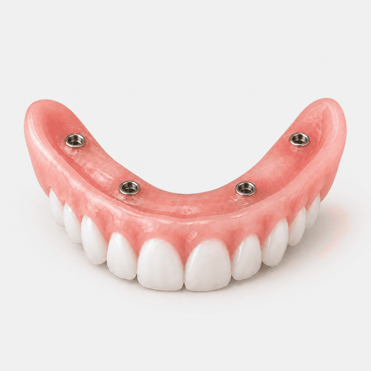 Implant Acrylic Denture