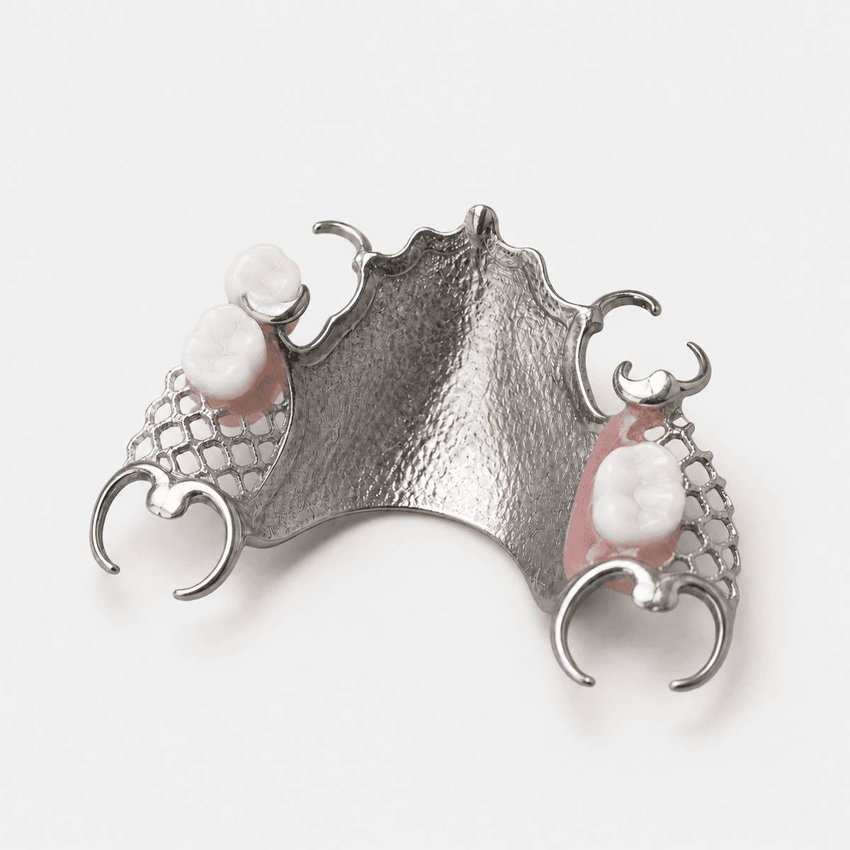 Partial Metal Framework