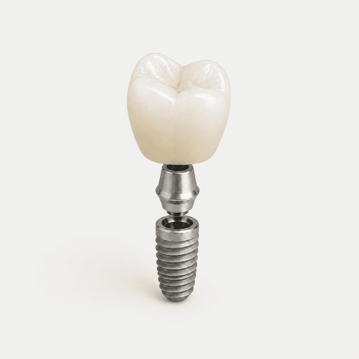 Implant Restorations